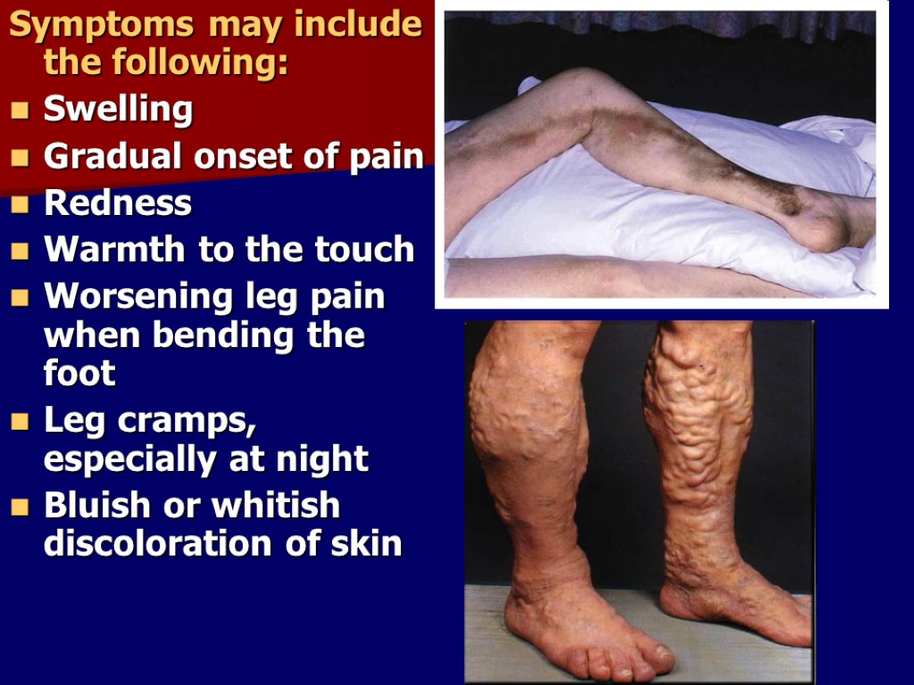 Symptoms may include the following: Swelling Gradual onset of pain Redness Warmth to the
